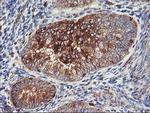 PFKP Antibody in Immunohistochemistry (Paraffin) (IHC (P))