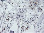 SDS Antibody in Immunohistochemistry (Paraffin) (IHC (P))