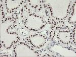 OBFC2B Antibody in Immunohistochemistry (Paraffin) (IHC (P))