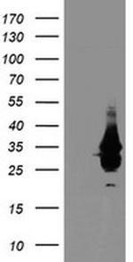 OBFC2B Antibody in Western Blot (WB)