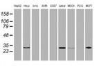 OBFC2B Antibody in Western Blot (WB)