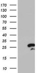 RGS16 Antibody in Western Blot (WB)