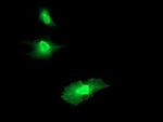 RGS16 Antibody in Immunocytochemistry (ICC/IF)