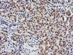 C20orf3 Antibody in Immunohistochemistry (Paraffin) (IHC (P))