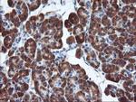 CD249 Antibody in Immunohistochemistry (Paraffin) (IHC (P))