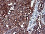 CD249 Antibody in Immunohistochemistry (Paraffin) (IHC (P))