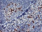 CD249 Antibody in Immunohistochemistry (Paraffin) (IHC (P))