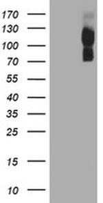 CD249 Antibody in Western Blot (WB)