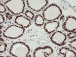 GOLPH2 Antibody in Immunohistochemistry (Paraffin) (IHC (P))