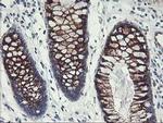 GOLPH2 Antibody in Immunohistochemistry (Paraffin) (IHC (P))