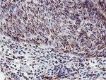 GOLPH2 Antibody in Immunohistochemistry (Paraffin) (IHC (P))