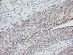 GOLPH2 Antibody in Immunohistochemistry (Paraffin) (IHC (P))