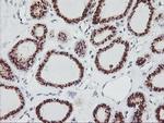 GOLPH2 Antibody in Immunohistochemistry (Paraffin) (IHC (P))