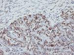 GOLPH2 Antibody in Immunohistochemistry (Paraffin) (IHC (P))