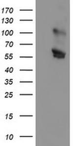 GOLPH2 Antibody in Western Blot (WB)