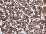 ERP72 Antibody in Immunohistochemistry (Paraffin) (IHC (P))