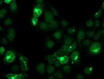 Cystatin S Antibody in Immunocytochemistry (ICC/IF)