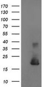 Cystatin S Antibody in Western Blot (WB)