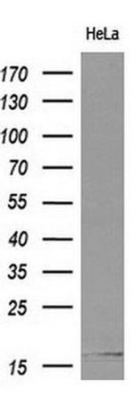 Cystatin S Antibody in Western Blot (WB)