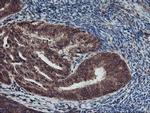 AGPAT5 Antibody in Immunohistochemistry (Paraffin) (IHC (P))