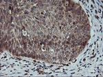 AGPAT5 Antibody in Immunohistochemistry (Paraffin) (IHC (P))