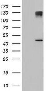 AGPAT5 Antibody in Western Blot (WB)