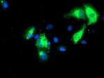 Kir3.1 (KCNJ3) Antibody in Immunocytochemistry (ICC/IF)