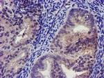 Kir3.1 (KCNJ3) Antibody in Immunohistochemistry (Paraffin) (IHC (P))