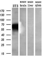 Kir3.1 (KCNJ3) Antibody in Western Blot (WB)