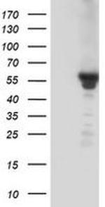 Kir3.1 (KCNJ3) Antibody in Western Blot (WB)