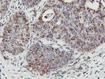 NMT2 Antibody in Immunohistochemistry (Paraffin) (IHC (P))