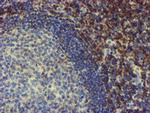 NMT2 Antibody in Immunohistochemistry (Paraffin) (IHC (P))