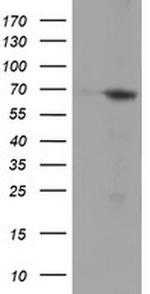 NMT2 Antibody in Western Blot (WB)