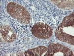 NLN Antibody in Immunohistochemistry (Paraffin) (IHC (P))