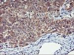 AGPAT5 Antibody in Immunohistochemistry (Paraffin) (IHC (P))