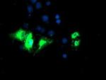 Kir3.1 (KCNJ3) Antibody in Immunocytochemistry (ICC/IF)