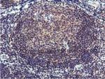 RFXANK Antibody in Immunohistochemistry (Paraffin) (IHC (P))