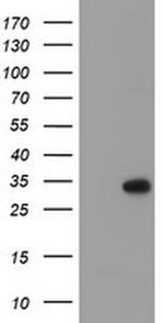 RFXANK Antibody in Western Blot (WB)