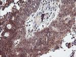 RFXANK Antibody in Immunohistochemistry (Paraffin) (IHC (P))