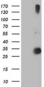 RFXANK Antibody in Western Blot (WB)