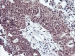 RFXANK Antibody in Immunohistochemistry (Paraffin) (IHC (P))