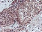 RFXANK Antibody in Immunohistochemistry (Paraffin) (IHC (P))