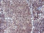 RFXANK Antibody in Immunohistochemistry (Paraffin) (IHC (P))