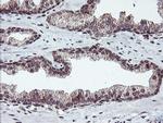 RFXANK Antibody in Immunohistochemistry (Paraffin) (IHC (P))