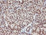 RFXANK Antibody in Immunohistochemistry (Paraffin) (IHC (P))