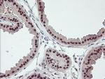 RFXANK Antibody in Immunohistochemistry (Paraffin) (IHC (P))