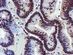 RFXANK Antibody in Immunohistochemistry (Paraffin) (IHC (P))