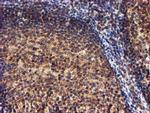 RFXANK Antibody in Immunohistochemistry (Paraffin) (IHC (P))