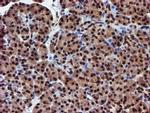 RFXANK Antibody in Immunohistochemistry (Paraffin) (IHC (P))