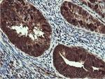 RUVBL2 Antibody in Immunohistochemistry (Paraffin) (IHC (P))